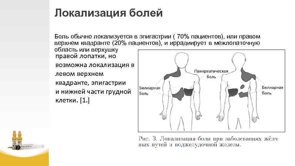 Локализация болей Боль обычно локализуется в эпигастрии ( 70% пациентов), или правом верхнем квадранте