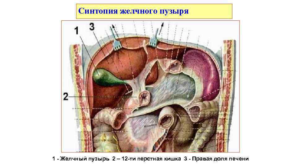 Синтопия желчного пузыря 1 - Желчный пузырь 2 – 12 -ти перстная кишка 3