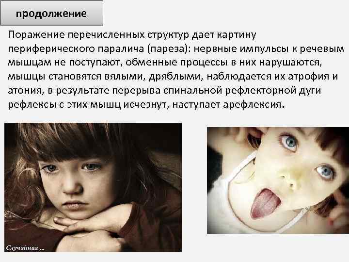 продолжение Поражение перечисленных структур дает картину периферического паралича (пареза): нервные импульсы к речевым мышцам