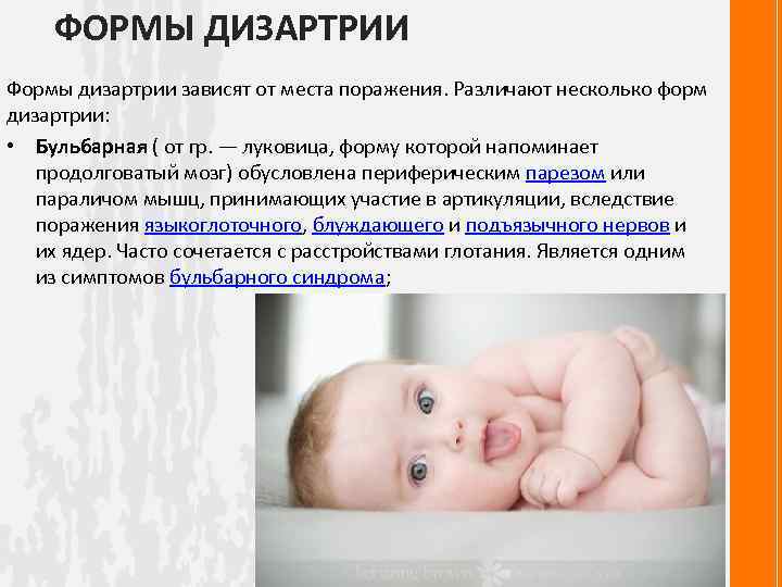 ФОРМЫ ДИЗАРТРИИ Формы дизартрии зависят от места поражения. Различают несколько форм дизартрии: • Бульбарная