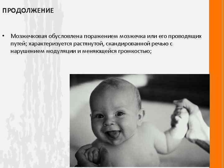 ПРОДОЛЖЕНИЕ • Мозжечковая обусловлена поражением мозжечка или его проводящих путей; характеризуется растянутой, скандированной речью