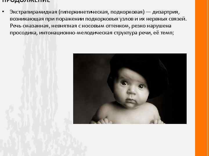 ПРОДОЛЖЕНИЕ • Экстрапирамидная (гиперкинетическая, подкорковая) — дизартрия, возникающая при поражении подкорковых узлов и их