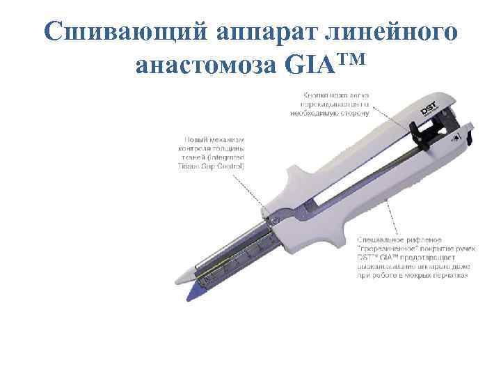 Сшивающий аппарат линейного анастомоза GIATM 