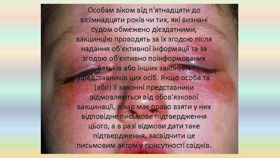 Особам віком від п'ятнадцяти до вісімнадцяти років чи тих, які визнані судом обмежено дієздатними,