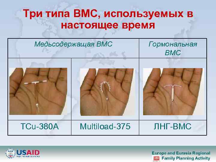 Три типа ВМС, используемых в настоящее время Медьсодержащая ВМС TCu-380 A Multiload-375 Гормональная ВМС