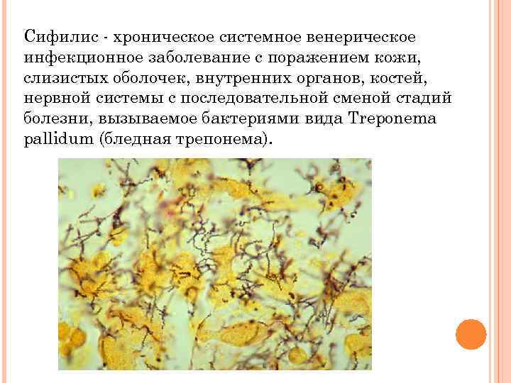 Сифилис - хроническое системное венерическое инфекционное заболевание с поражением кожи, слизистых оболочек, внутренних органов,