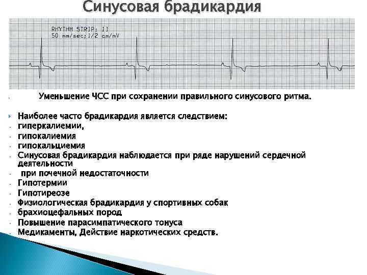 Брадикардия карта вызова