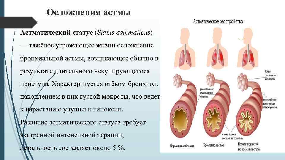 Сайт астм. Осложнения бронхиальной астмы. Астматический статус при бронхиальной астме. Бронхиальная астма статус астматикус. Легочные осложнения бронхиальной астмы.