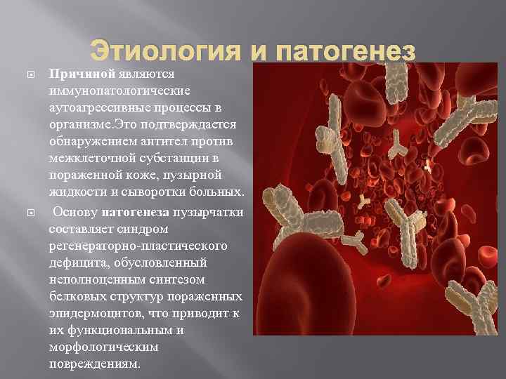 Этиология и патогенез Причиной являются иммунопатологические аутоагрессивные процессы в организме. Это подтверждается обнаружением антител