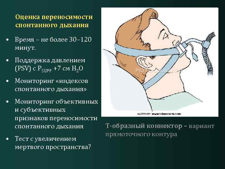 Операции дыхания. Методы мониторирования спонтанного дыхания и при ИВЛ.. Спонтанное дыхание. Методики отлучения от ИВЛ. Дыхательное Мертвое пространство.