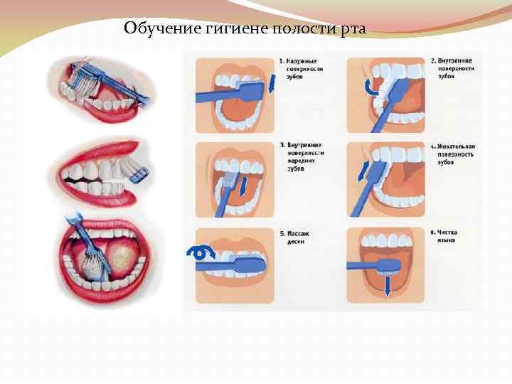 Обучение гигиене полости рта 