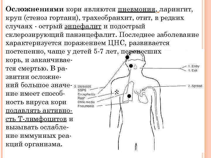 Осложнениями кори являются пневмония, ларингит, круп (стеноз гортани), трахеобранхит, отит, в редких случаях -
