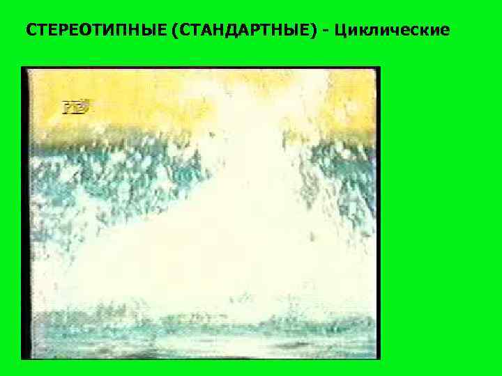 СТЕРЕОТИПНЫЕ (СТАНДАРТНЫЕ) - Циклические 