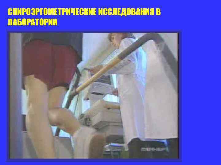 СПИРОЭРГОМЕТРИЧЕСКИЕ ИССЛЕДОВАНИЯ В ЛАБОРАТОРИИ 