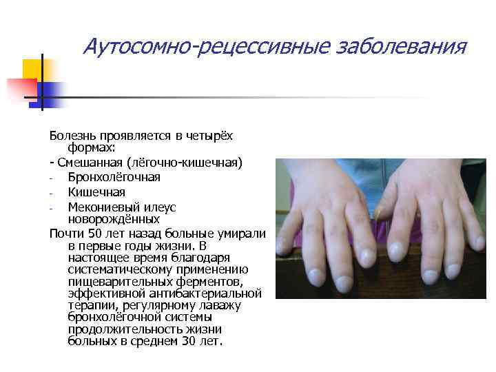 Аутосомно-рецессивные заболевания Болезнь проявляется в четырёх формах: - Смешанная (лёгочно-кишечная) Бронхолёгочная Кишечная Мекониевый илеус