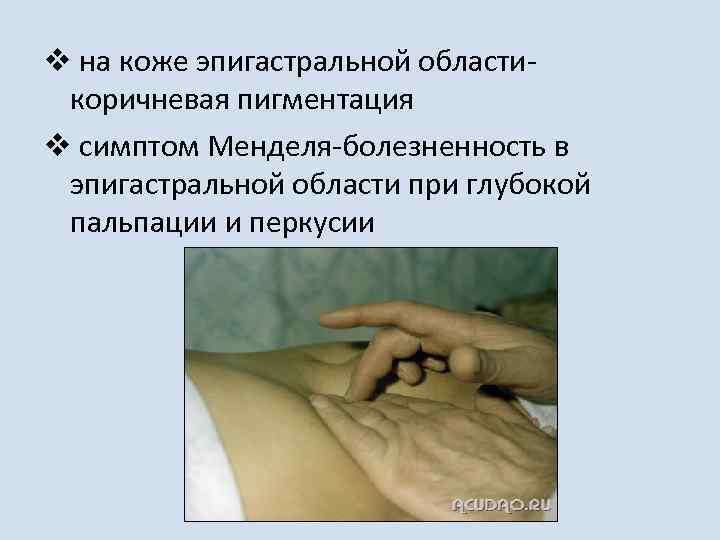 v на коже эпигастральной областикоричневая пигментация v симптом Менделя-болезненность в эпигастральной области при глубокой