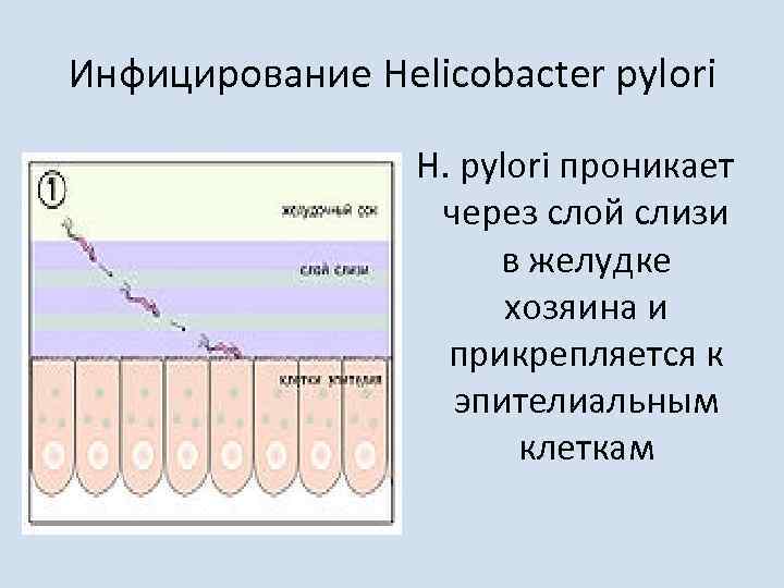 Продукты убивающие хеликобактер. Инфицирование Helicobacter pylori. Продукты убивающие хеликобактер пилори. Норма хеликобактер пилори в желудке. Степени заражения хеликобактер пилори.