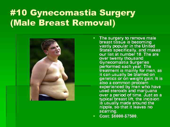 #10 Gynecomastia Surgery (Male Breast Removal) § The surgery to remove male breast tissue