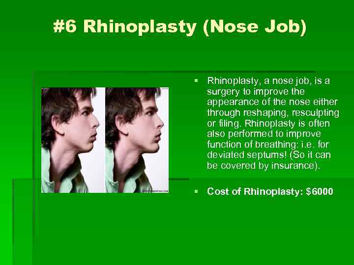 #6 Rhinoplasty (Nose Job) § Rhinoplasty, a nose job, is a surgery to improve