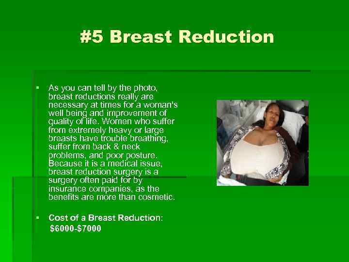 #5 Breast Reduction § As you can tell by the photo, breast reductions really