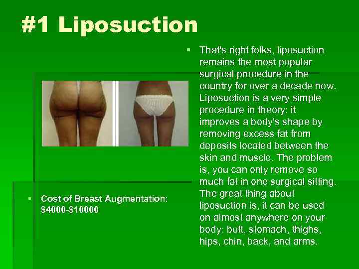 #1 Liposuction § Cost of Breast Augmentation: $4000 -$10000 § That's right folks, liposuction