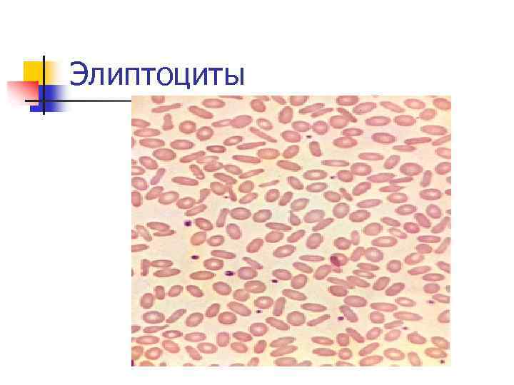 Элиптоциты 