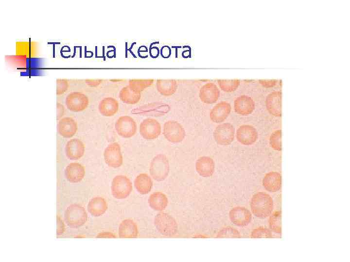 Тельца Кебота 