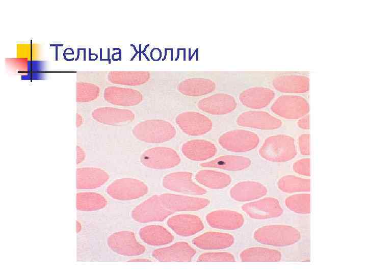 Тельца Жолли 