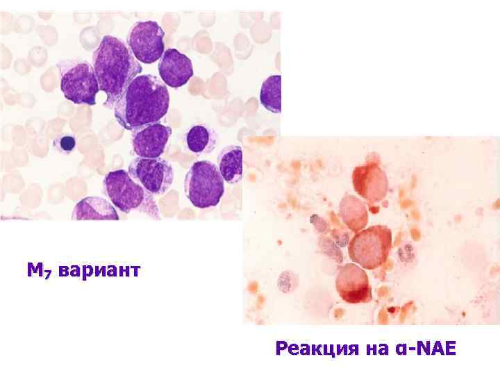 М 7 вариант Реакция на α-NAE 