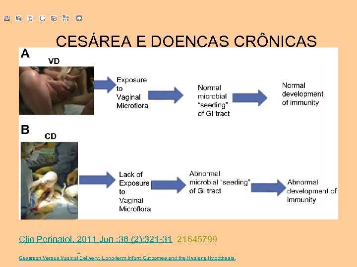 CESÁREA E DOENÇAS CRÔNICAS Clin Perinatol. 2011 Jun ; 38 (2): 321 -31 21645799