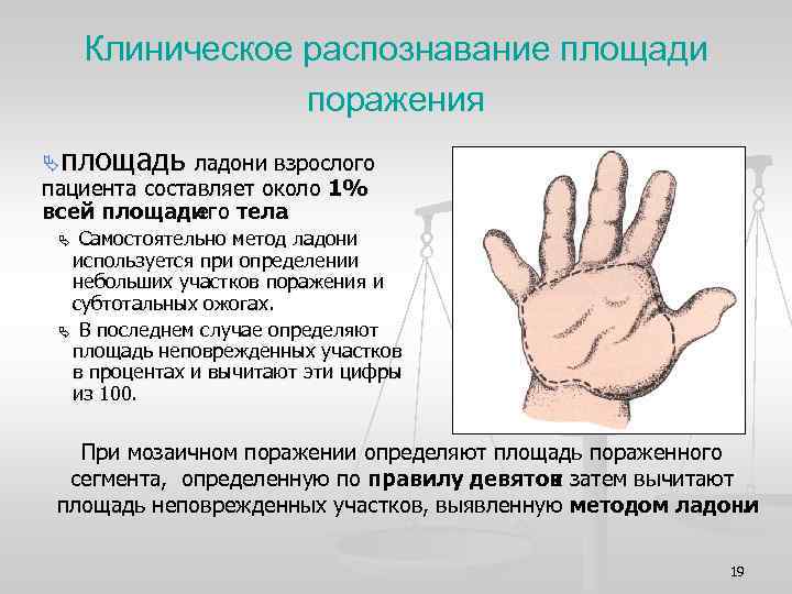 Клиническое распознавание площади поражения Äплощадь ладони взрослого пациента составляет около 1% всей площади тела