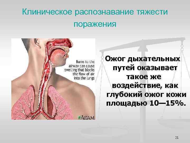 Клиническое распознавание тяжести поражения Ожог дыхательных путей оказывает такое же воздействие, как глубокий ожог