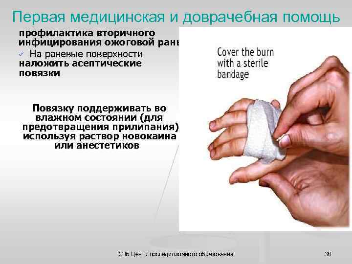 Первая медицинская и доврачебная помощь профилактика вторичного инфицирования ожоговой раны ü На раневые поверхности
