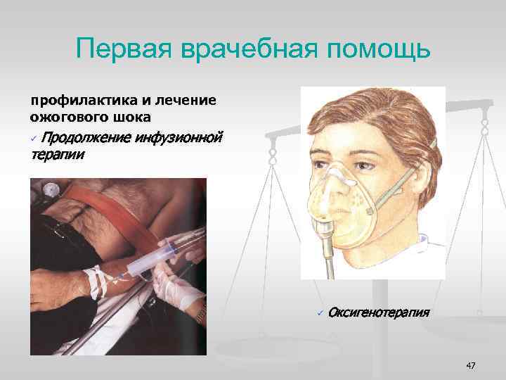 Первая врачебная помощь профилактика и лечение ожогового шока Продолжение инфузионной терапии ü ü Оксигенотерапия