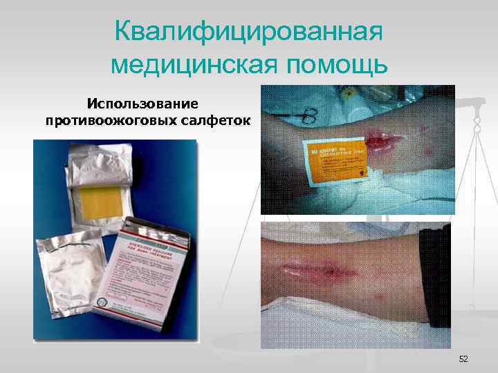 Квалифицированная медицинская помощь Использование противоожоговых салфеток 52 