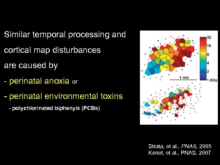 Similar temporal processing and cortical map disturbances are caused by - perinatal anoxia or