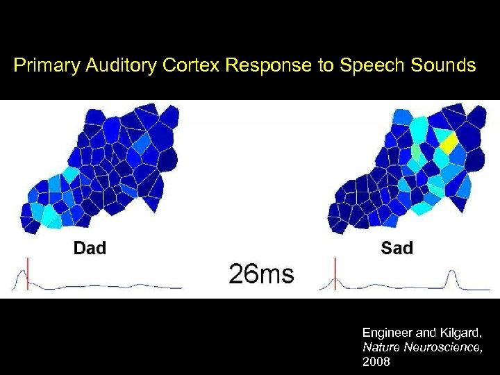Primary Auditory Cortex Response to Speech Sounds Engineer and Kilgard, Nature Neuroscience, 2008 