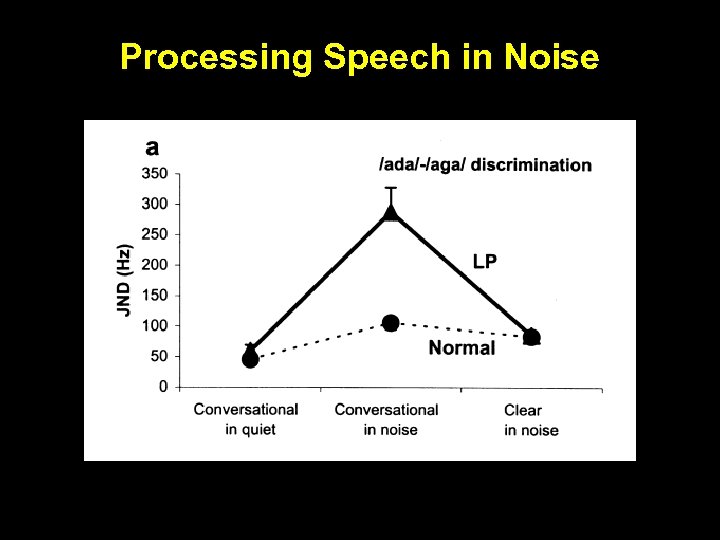 Processing Speech in Noise 