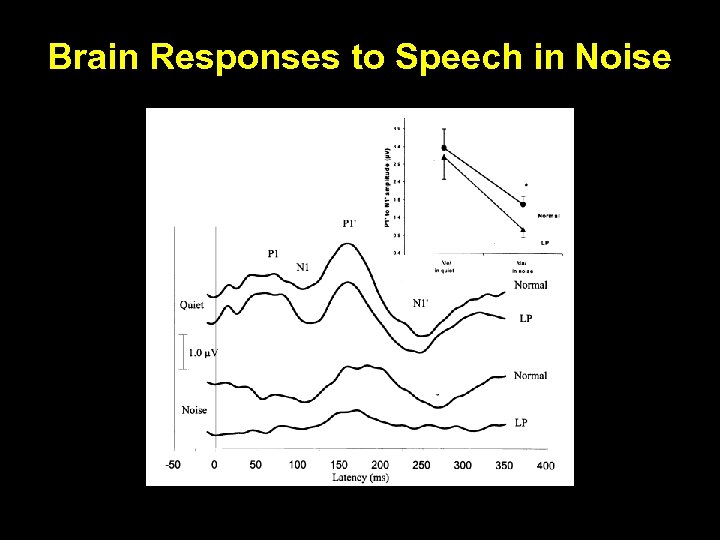 Brain Responses to Speech in Noise 