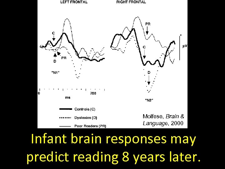 Molfese, Brain & Language, 2000 Infant brain responses may predict reading 8 years later.