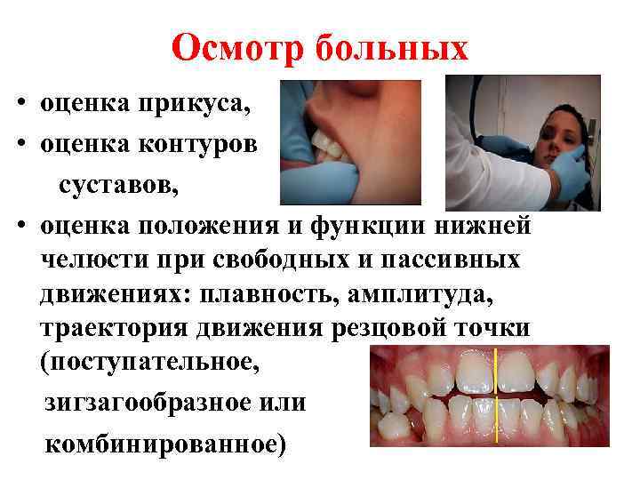 Осмотр больных • оценка прикуса, • оценка контуров суставов, • оценка положения и функции