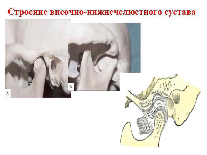 Строение височно-нижнечелюстного сустава 