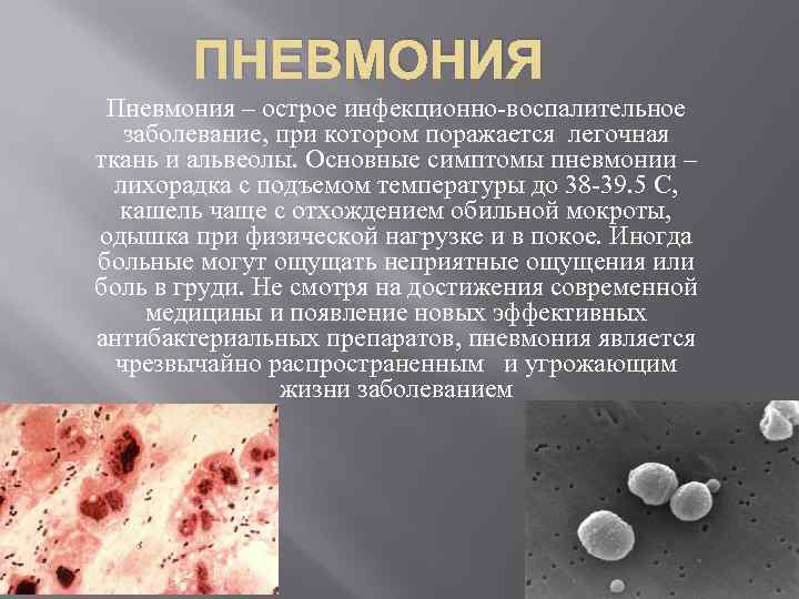 ПНЕВМОНИЯ Пневмония – острое инфекционно-воспалительное заболевание, при котором поражается легочная ткань и альвеолы. Основные