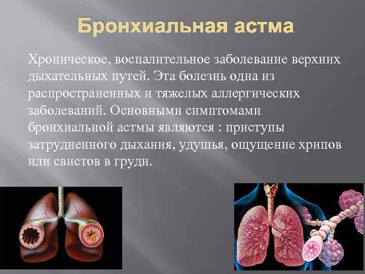 Бронхиальная астма Хроническое, воспалительное заболевание верхних дыхательных путей. Эта болезнь одна из распространенных и