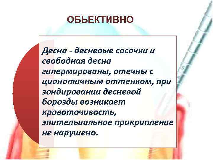 ОБЬЕКТИВНО Десна - десневые сосочки и свободная десна гипермированы, отечны с цианотичным оттенком, при