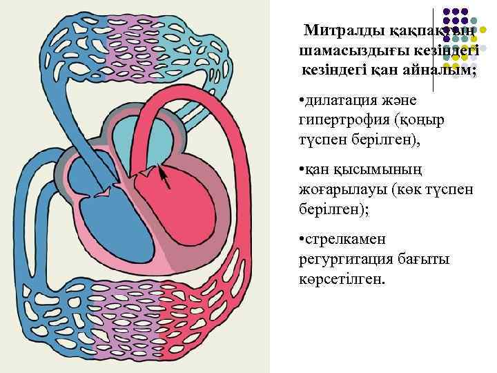 Митралды қақпақтың шамасыздығы кезіндегі қан айналым; • дилатация және гипертрофия (қоңыр түспен берілген), •