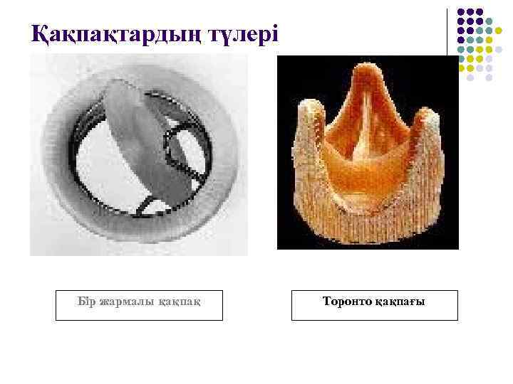 Қақпақтардың түлері Бір жармалы қақпақ Торонто қақпағы 