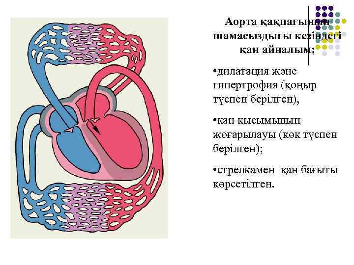 Аорта қақпағының шамасыздығы кезіндегі қан айналым; • дилатация және гипертрофия (қоңыр түспен берілген), •