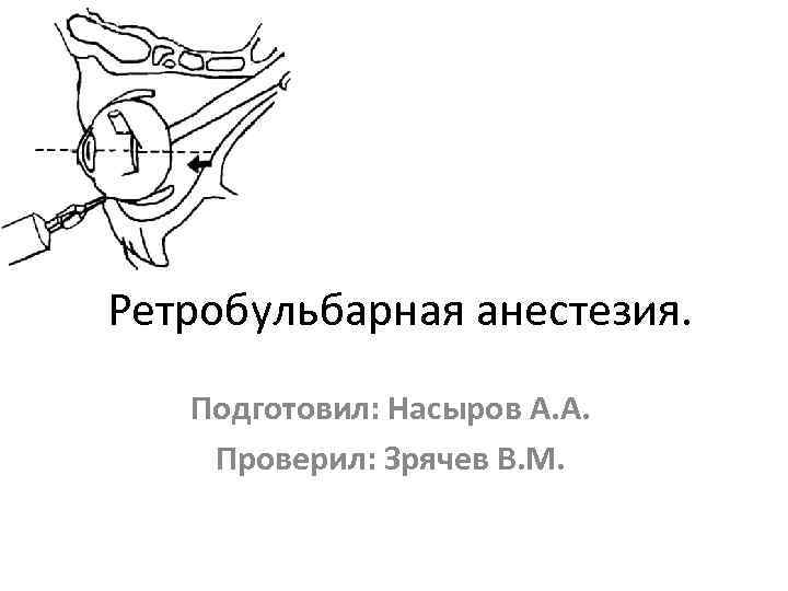 Ретробульбарная анестезия. Подготовил: Насыров А. А. Проверил: Зрячев В. М. 