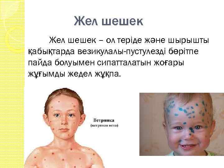 Жел шешек – ол терiде және шырышты қабықтарда везикулалы-пустулездi бөрiтпе пайда болуымен сипатталатын жоғары